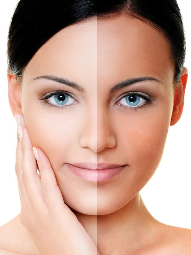 How To Remove Tan From The Face And Skin – 12 Remedies, Treatment Options + Tips